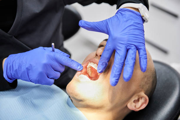 Best Emergency Treatment for Dental Infections or Abscesses in Springfield, MN